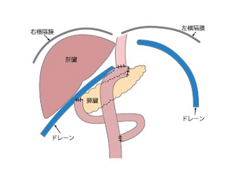 Pd1pdl1meta Pd1pdl1meta