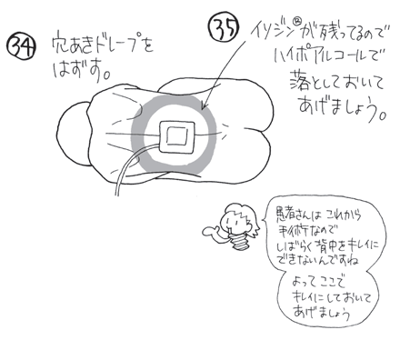 硬膜外麻酔（エピ）の穿刺部位と手順【マンガでわかる看護技術