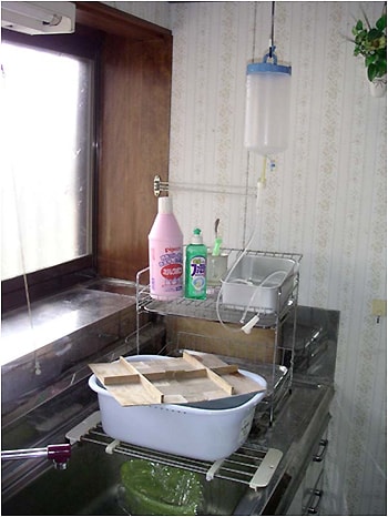 第11回 経腸栄養時の管理 栄養剤の調整 器具の洗浄 フラッシュ等 ナース専科