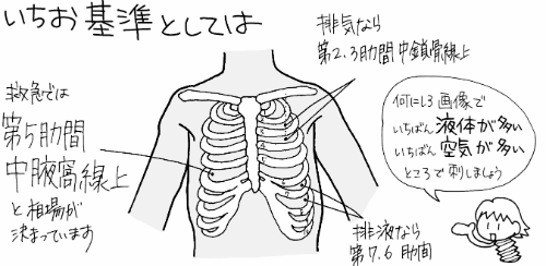 アフターケアと回復のヒント