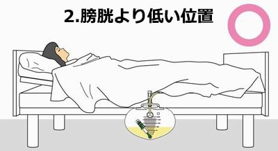 定期購読プレゼント企画 フォーリーカテーテル適正使用編 ナース専科 Part 2 定期購読プレゼント企画 フォーリーカテーテル適正使用編 ナース専科 Part 2