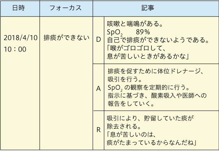 SOAP、フォーカスチャーティング、経時記録の書き方のポイント