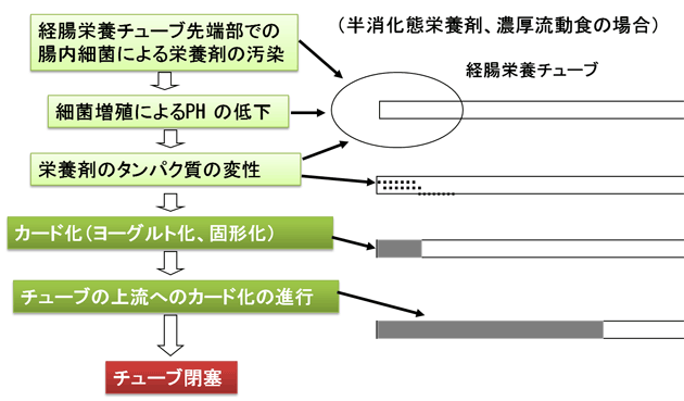 第11回 経腸栄養時の管理 栄養剤の調整 器具の洗浄 フラッシュ等 ナース専科