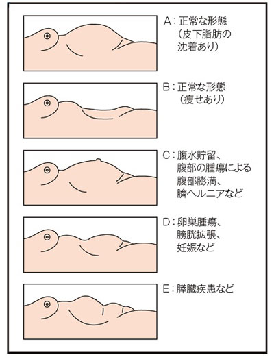 皮膚状態 腹部の観察 腹部の聴診法 消化器のフィジカルアセスメント 1 ナース専科