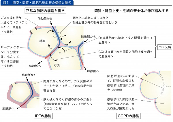 症例から学ぶ間質性肺炎の臨床・画像・病理 症例から学ぶ 間質性肺炎の臨床・画像・病理 | 田口善夫, 野間惠