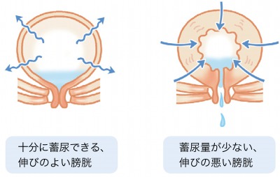 泌尿器ケア 14年冬季増刊 カラ-イラストでわかる！ /メディカ
